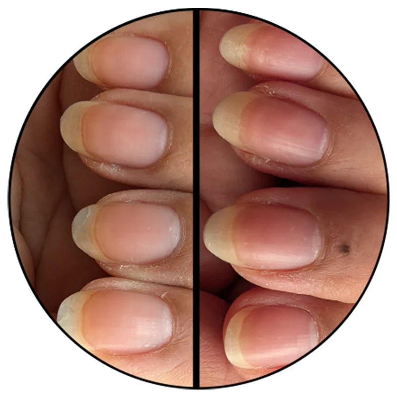 Advanced Nail Strengthener